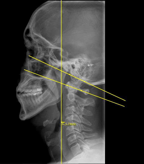 WHAT TO EXPECT — Harborside Chiropractic- Chiropractor | Dr